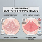 V Cure Instant Cream
